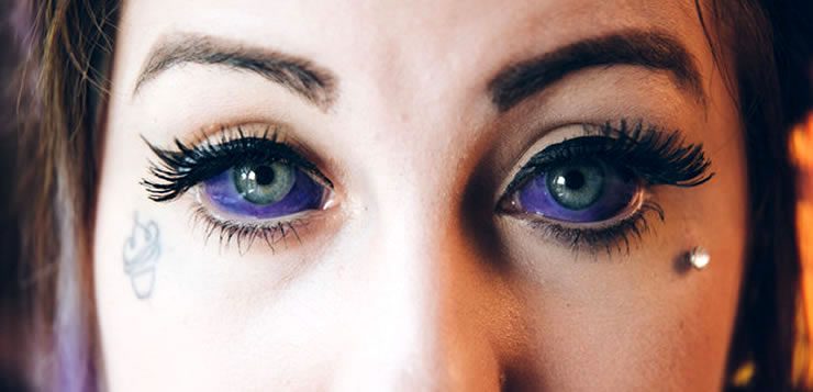 Nas modificações corporais a tatuagem no globo ocular é conhecida como “scleral tattooing”